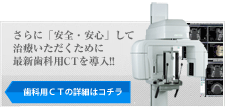 CTが導入されました