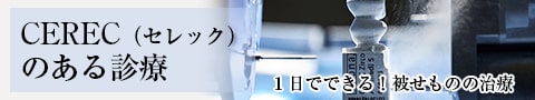 セレック
