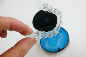 お手軽前歯矯正